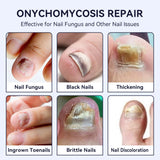 Hand and Foot Nail Care Solution – Thickening, Brightening & Antibacterial Treatment for Gray Nails