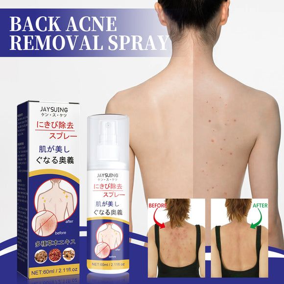 Back Care Spray, Smallpox Diluting Back Acne Cleaning and Repair Formula