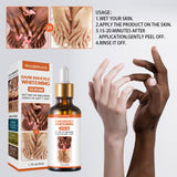 Dark Knuckle Brightening Serum – Skin Tone Evening & Dark Spot Care for Hands, Elbows and Knees