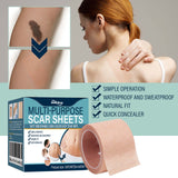 Skin Tone Concealer Patches – Invisible Cover for Scars, Tattoos and Blemishes