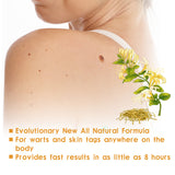 Skin Cleansing Wart Care Cream for External Use