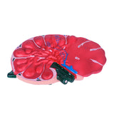 Lymph Node Enlargement Model, Biology Teaching Instrument