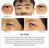 Ageless Eye Wrinkle Cream