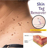 External Wart Care Pen for Mild & Flat Warts