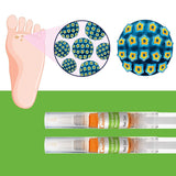 External Wart Care Pen for Common & Flat Warts