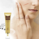 Ladies Herbal Repair Formula, Scar Removal Cream