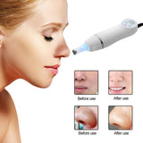 Pore Cleaner, Electric Blackhead Remover