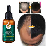 Unisex Hair Follicle Repair Essential Oil