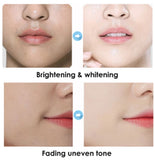 Moisturizing and Hydrating, Ice Cream Mask Fades Acne Marks and Blackheads