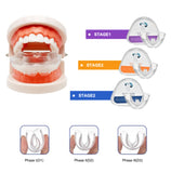 Silicone Sports Mouth Breathing Braces