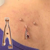 Skin Care Device for Mole & Wart Areas – Physical Method