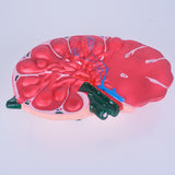 Lymph Node Enlargement Model, Biology Teaching Instrument