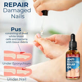Bright Nail Repair Oil for Thickened Nail Grooves Treatment