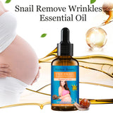 Snail Belly Fade Lines Massage Oil (Pack of 2)