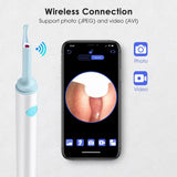 Visible Luminous, Ear Spoon Endoscope