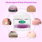 Skin Rebound Scarless Cream, Scar Removal Face Gel for Face Acne Scar Stretch Marks, Skin Repair Formula