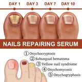 Thickening Nail Repair Serum for Hands and Feet – Improves Onychomycosis