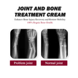 Protein Cream Soothes Joint Bone Soreness and Deformation, Correction and Repair Formula (Pack of 2)