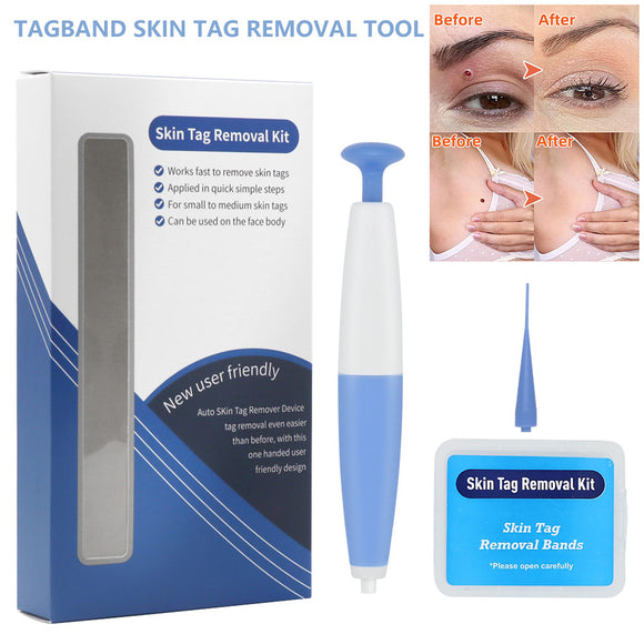 Skin Tag Removal Kit, Home Use Mole Wart Remover, Micro Band Skin Tag Treatment Tool, Easy to Clean Device