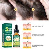 Eelhoe Ginger Hair Essential Oil – Nourishing Scalp & Hair Care Treatment