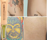 Tattoo Removal Cream (Pack of 2)