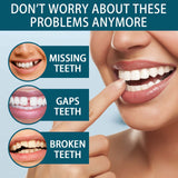 Adjustable Snap-on Denture, Temporary Filling Braces