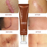 Moisturizing and Repairing Scars, Skin Care Cream