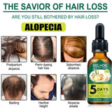 Eelhoe Ginger Hair Essential Oil – Nourishing Scalp & Hair Care Treatment