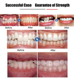 Multifunctional Invisible Orthodontic Braces