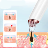 Electric Blackhead Cleansing Instrument