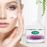 Skin Rebound Scarless Cream, Scar Removal Face Gel for Face Acne Scar Stretch Marks, Skin Repair Formula