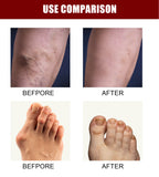 Perfectx Collagen, Egg White Icing, Joint Cream, Intensive Concentrate Lotion for Bone Therapy