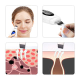 Multifunctional Blackhead and Dead Skin Beauty Equipment