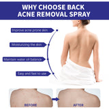 Back Care Spray, Smallpox Diluting Back Acne Cleaning and Repair Formula