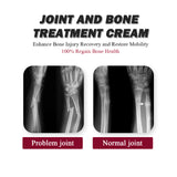 Protein Cream Soothes Joint Bone Soreness and Deformation, Correction and Repair Formula (Pack of 2)