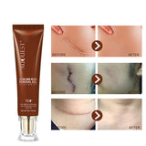 Moisturizing and Repairing Scars, Skin Care Cream