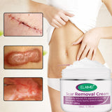 Skin Rebound Scarless Cream, Scar Removal Face Gel for Face Acne Scar Stretch Marks, Skin Repair Formula