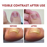 Soft and Bright Nail Repair, Inlay Thickening Type, Grey Groove Care Oil