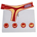 Creative Human Vascular Enlargement Model