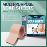 Skin Tone Concealer Patches – Invisible Cover for Scars, Tattoos and Blemishes