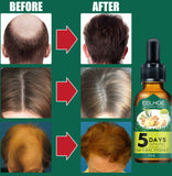 Eelhoe Ginger Hair Essential Oil – Nourishing Scalp & Hair Care Treatment