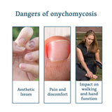 Nail Repair – Treats Embedded, Thickened Nails and Restores Brightness