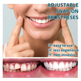 Adjustable Snap-on Denture, Temporary Filling Braces