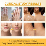 White Spot Care Cream, Emulsifiable Paste (Pack of 2)