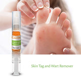 External Wart Care Pen for Common & Flat Warts