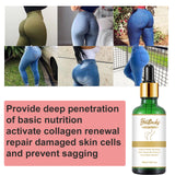 Lifting & Firming Essential Oil for Cellulite Reduction