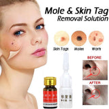 External Skin Care Cream for Mole Areas (Pack of 2)