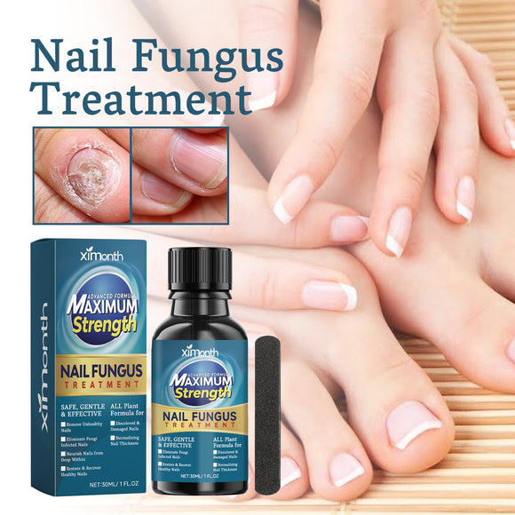 Nail Repair – Treats Embedded, Thickened Nails and Restores Brightness
