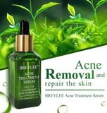 Acne Treatment Serum, Facial Skin Repair Oil