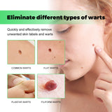Skin Cleansing Soap for Wart-prone & Spot Areas
